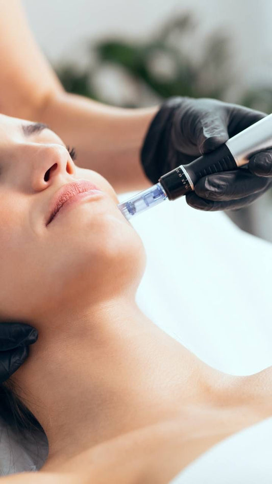 Microneedling